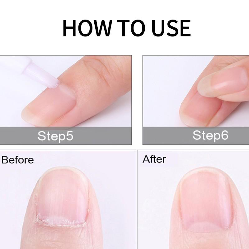 Professionelle kurze Nagelhaut – Tech Accessories Products Bewertung und Preis